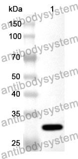 Anti-CD120b/TNFRSF1B Polyclonal Antibody