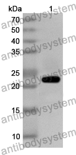 Anti-Human RAB3A Polyclonal Antibody