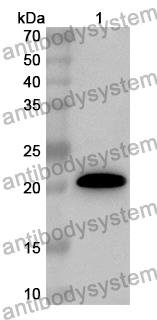 Anti-Human RAB4A Polyclonal Antibody