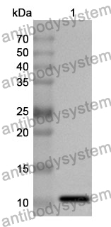 Anti-RAB5A Polyclonal Antibody