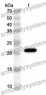 Anti-Human RAB6A Polyclonal Antibody