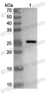 Anti-Human TAC1 Polyclonal Antibody