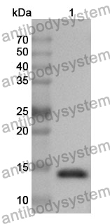 Anti-PVALB Polyclonal Antibody