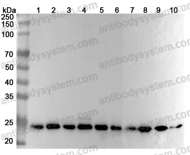 Anti-Human PSMB1 Polyclonal Antibody