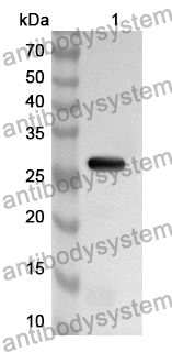 Anti-CD11a/ITGAL Polyclonal Antibody