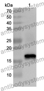 Anti-OGN Polyclonal Antibody