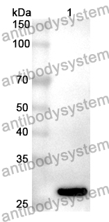 Anti-CAPN3 Polyclonal Antibody