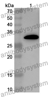 Anti-IL11 Polyclonal Antibody