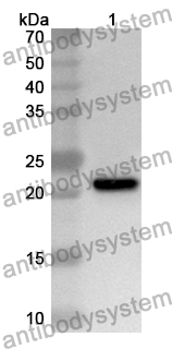 Anti-EFNA1 Polyclonal Antibody