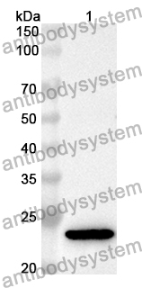 Anti-Human SERPINA2 Polyclonal Antibody