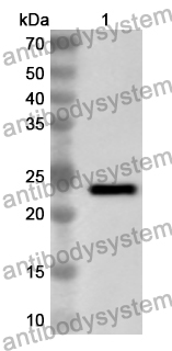 Anti-Human FLG Polyclonal Antibody