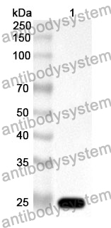 Anti-AGA Polyclonal Antibody