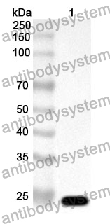 Anti-RASA1 Polyclonal Antibody