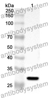 Anti-GSTM3 Polyclonal Antibody