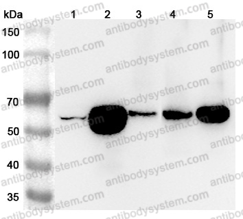 Anti-Human ATP6V1B2 Polyclonal Antibody