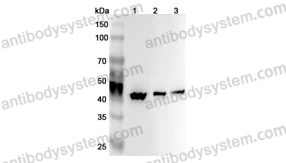 Anti-Human ATP6V1C1 Polyclonal Antibody