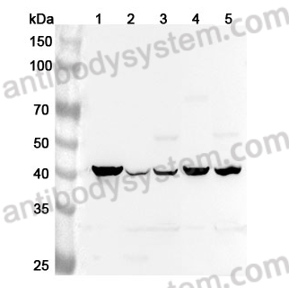 Anti-TACR2 Polyclonal Antibody