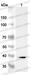 Anti-Human AGXT Polyclonal Antibody