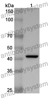 Anti-Human CNR1/CB1 Polyclonal Antibody