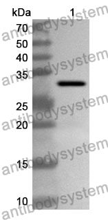 Anti-EPHA1 Polyclonal Antibody