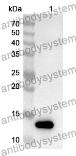 Anti-DRD1 Polyclonal Antibody