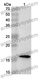 Anti-Human CD88/C5AR1 Polyclonal Antibody