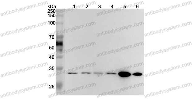 Anti-VDAC1 Polyclonal Antibody