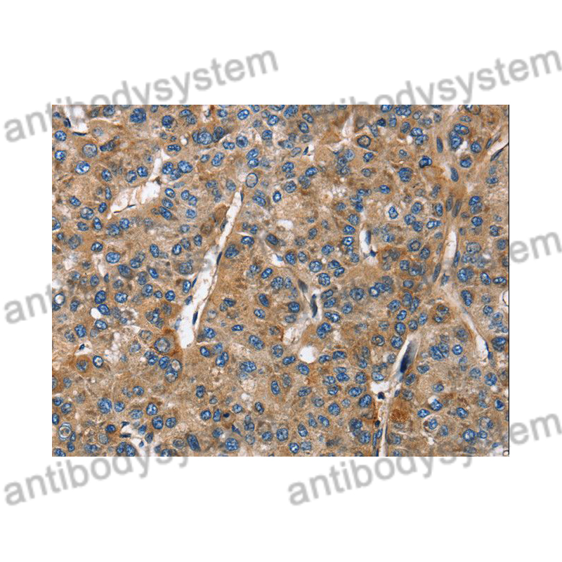 Anti-BGN Polyclonal Antibody