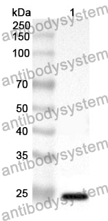 Anti-CD72 Polyclonal Antibody