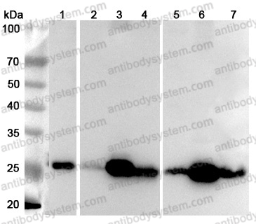 Anti-Human SDHB Polyclonal Antibody