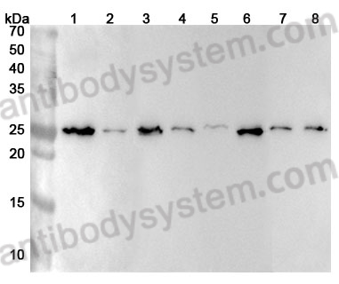 Anti-Human PCMT1 Polyclonal Antibody