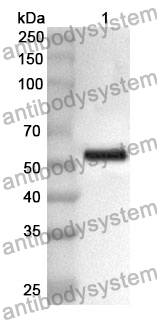 Anti-Human TNXB Polyclonal Antibody