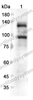 Anti-CDH3 Polyclonal Antibody