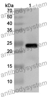 Anti-ACHE Polyclonal Antibody