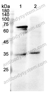 Anti-IDS Polyclonal Antibody