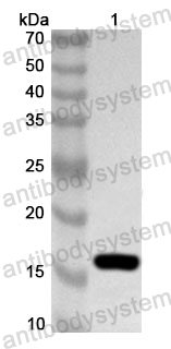 Anti-Human USF1 Polyclonal Antibody