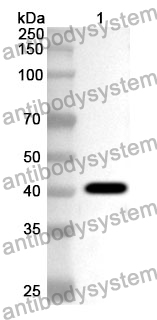 Anti-CD334/FGFR4 Polyclonal Antibody