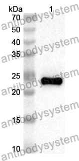 Anti-Human KCNA4 Polyclonal Antibody