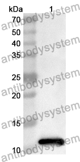 Anti-HNRNPA2B1 Polyclonal Antibody