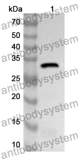 Anti-Calretinin/CALB2 Polyclonal Antibody