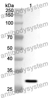 Anti-IGFBP4 Polyclonal Antibody