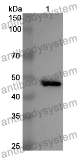 Anti-Human UQCRC2 Polyclonal Antibody