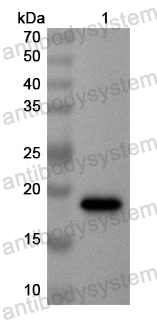 Anti-Human SLC2A5 Polyclonal Antibody