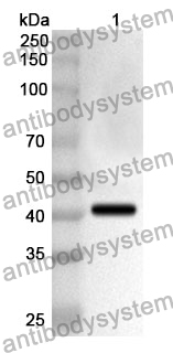 Anti-TGM1 Polyclonal Antibody