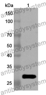 Anti-Human LHCGR Polyclonal Antibody