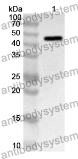 Anti-Human MMP8 Polyclonal Antibody