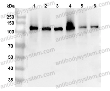 Anti-CD49f/ITGA6 Polyclonal Antibody