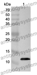 Anti-S100A1 Polyclonal Antibody