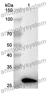 Anti-WARS1 Polyclonal Antibody