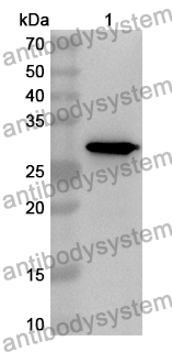 Anti-Human GLRA1 Polyclonal Antibody